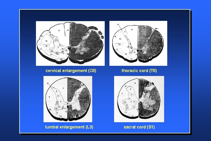 cervical enlargement (C 8) lumbal enlargement (L 3) thoracic cord (T 8) sacral cord