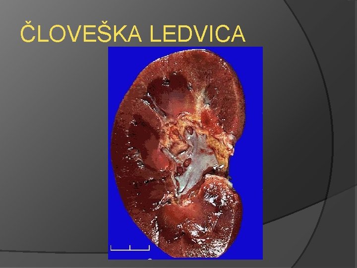 ČLOVEŠKA LEDVICA 