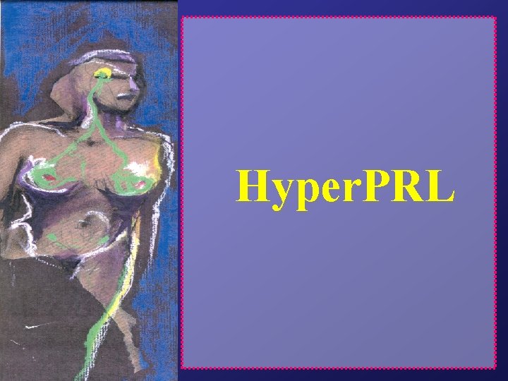 Hyper. PRL 