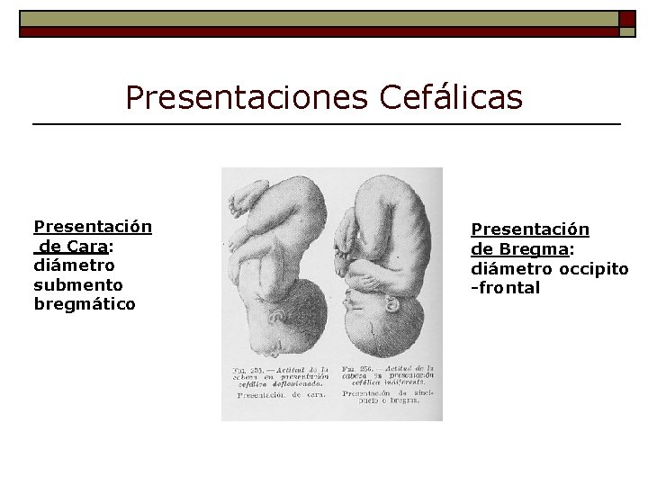 Presentaciones Cefálicas Presentación de Cara: diámetro submento bregmático Presentación de Bregma: diámetro occipito -frontal