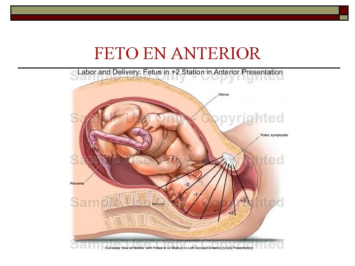FETO EN ANTERIOR 