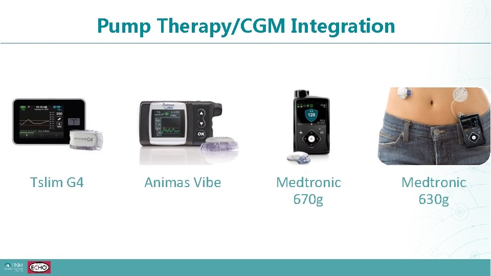 Pump Therapy/CGM Integration Tslim G 4 Animas Vibe Medtronic 670 g Medtronic 630 g