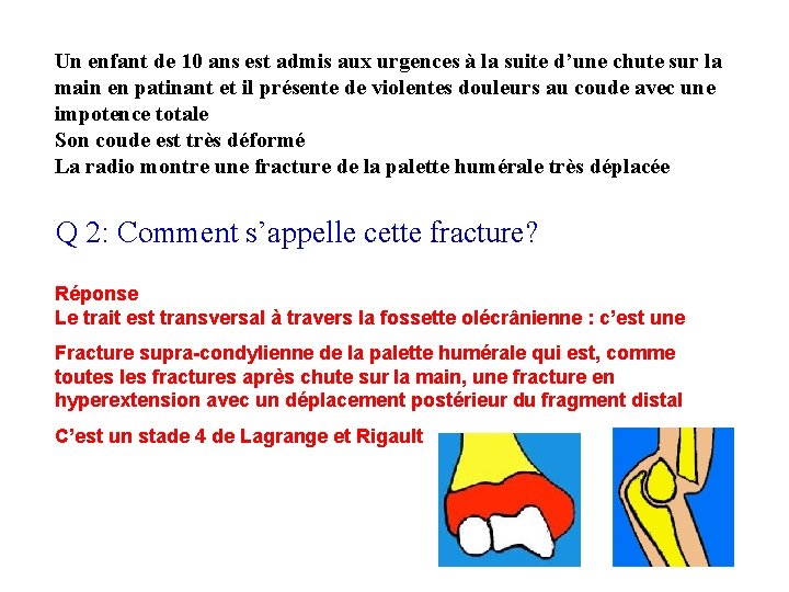 Un enfant de 10 ans est admis aux urgences à la suite d’une chute