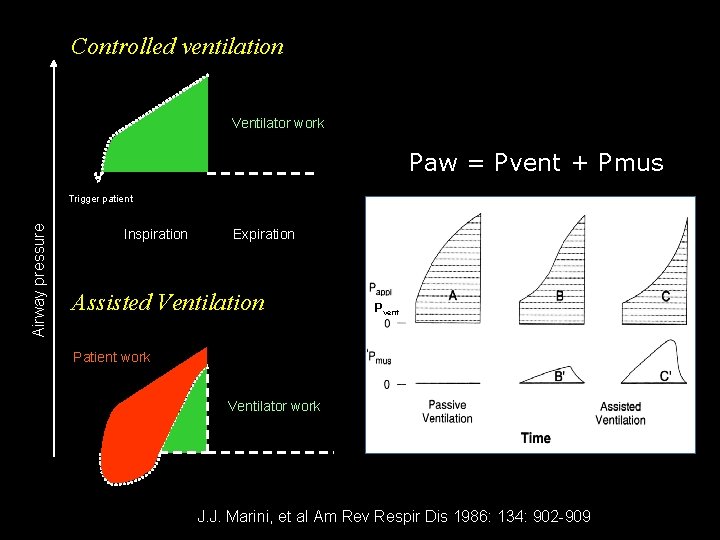 Controlled ventilation Ventilator work Paw = Pvent + Pmus Airway pressure Trigger patient Inspiration