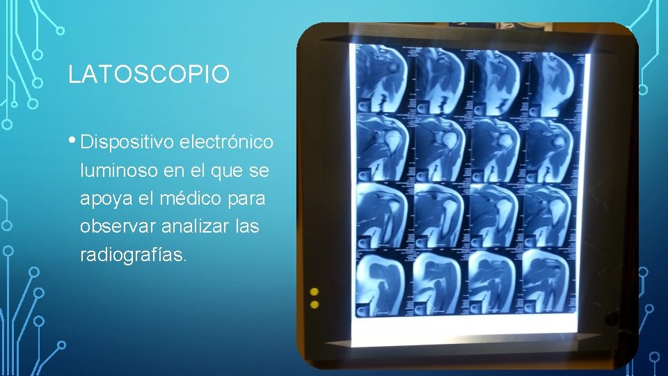 LATOSCOPIO • Dispositivo electrónico luminoso en el que se apoya el médico para observar