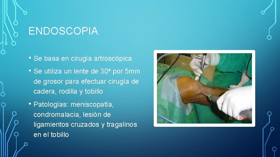 ENDOSCOPIA • Se basa en cirugía artroscópica • Se utiliza un lente de 30º
