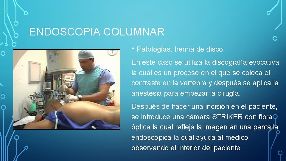 ENDOSCOPIA COLUMNAR • Patologías: hernia de disco En este caso se utiliza la discografía