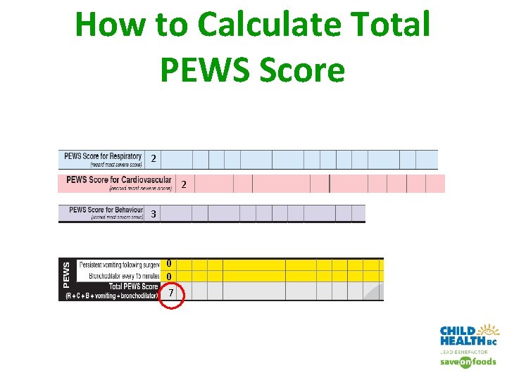 How to Calculate Total PEWS Score 2 2 3 0 0 7 