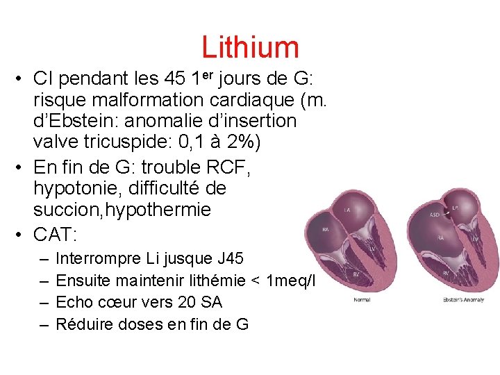 Lithium • CI pendant les 45 1 er jours de G: risque malformation cardiaque