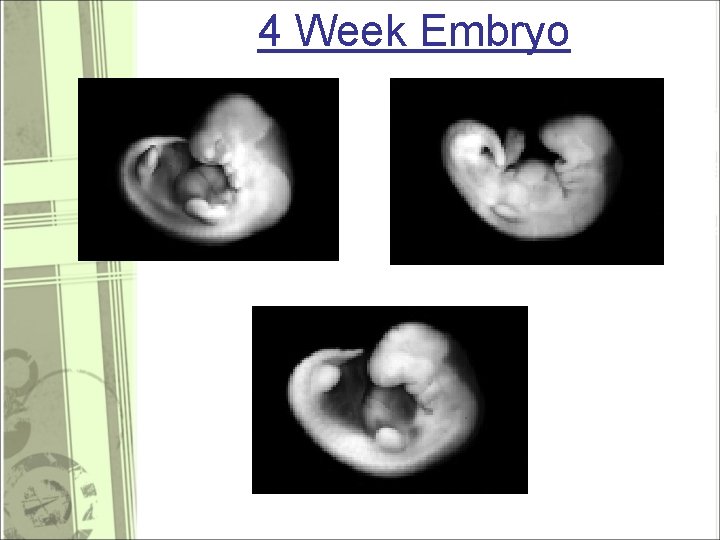 4 Week Embryo 