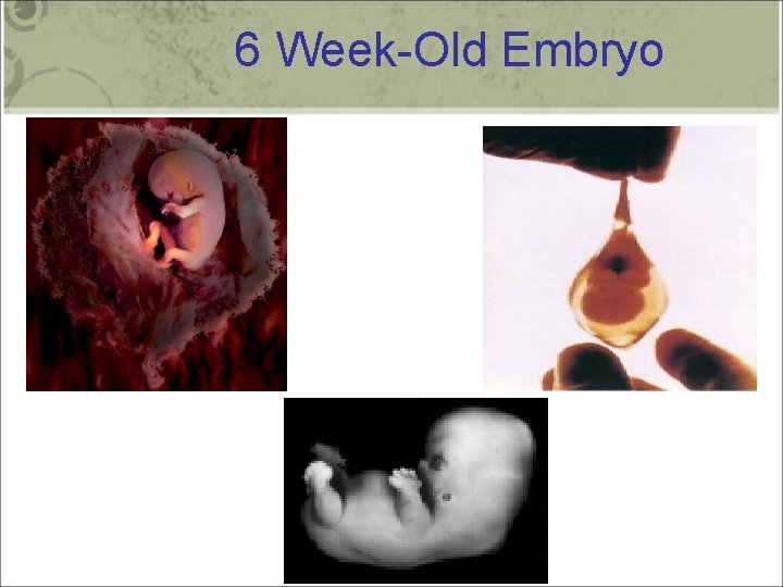 6 Week-Old Embryo 