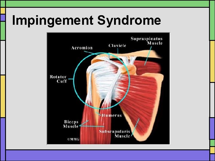 Impingement Syndrome Impingement Syndrome