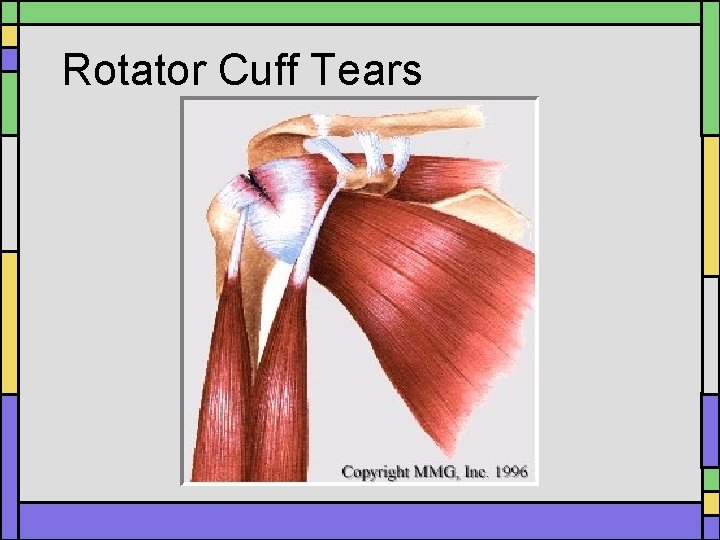 Rotator Cuff Tears Rotator Cuff Tears