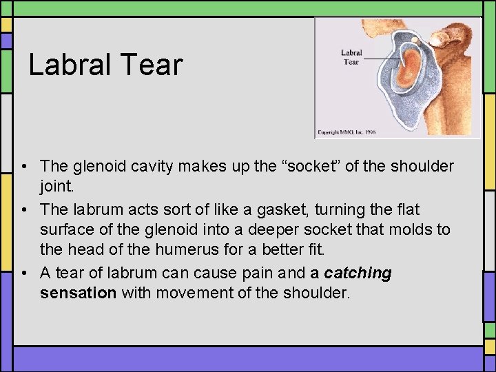 Labral Tear • The glenoid cavity makes up the “socket” of the shoulder joint. Labral Tear • The glenoid cavity makes up the “socket” of the shoulder joint.