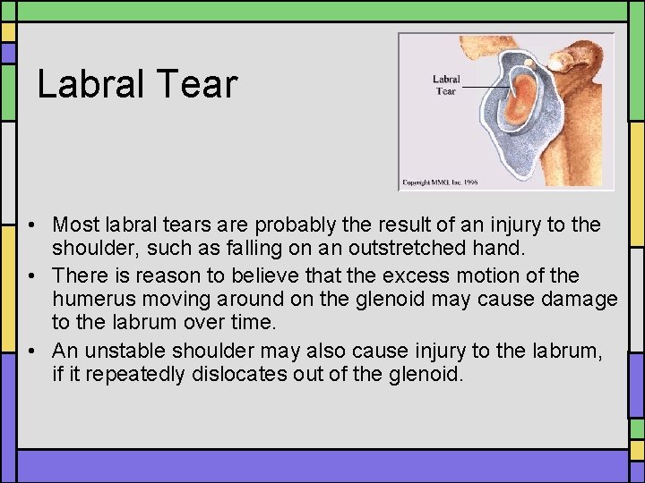 Labral Tear • Most labral tears are probably the result of an injury to Labral Tear • Most labral tears are probably the result of an injury to