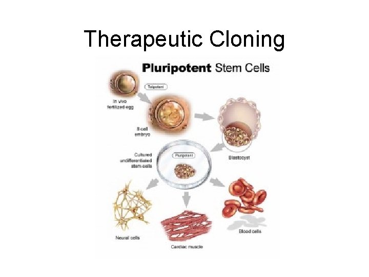 Therapeutic Cloning 