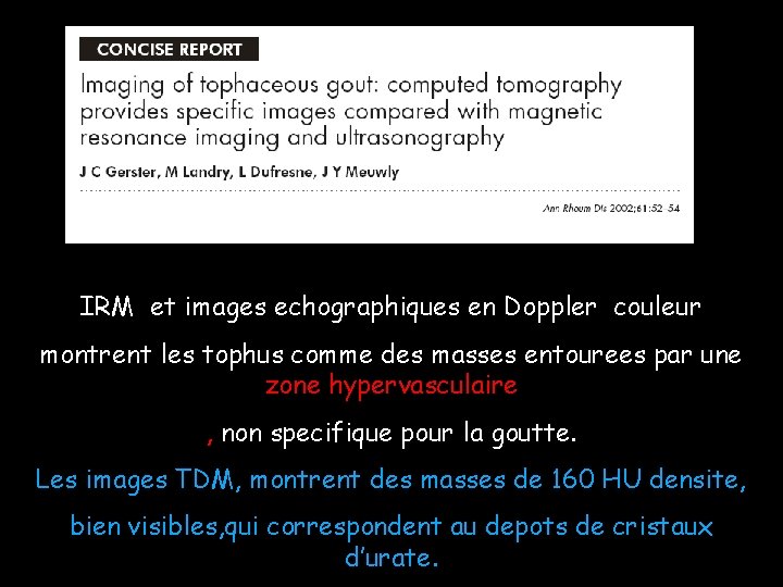 IRM et images echographiques en Doppler couleur montrent les tophus comme des masses entourees
