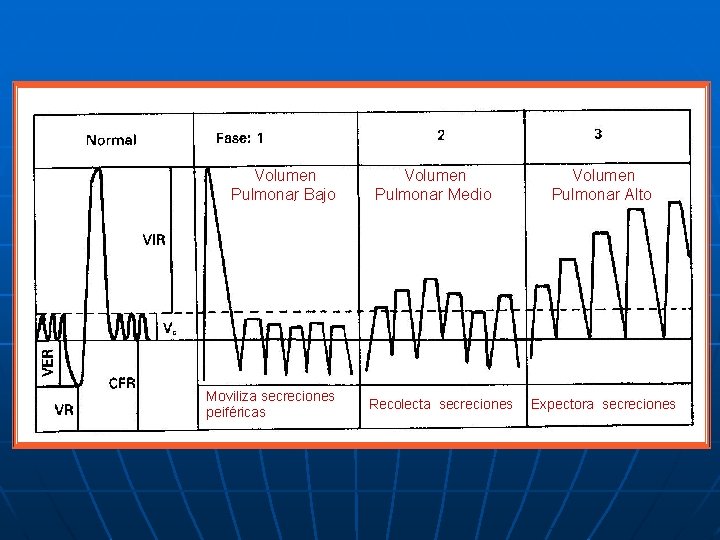 Volumen Pulmonar Bajo Moviliza secreciones peiféricas Volumen Pulmonar Medio Recolecta secreciones Volumen Pulmonar Alto