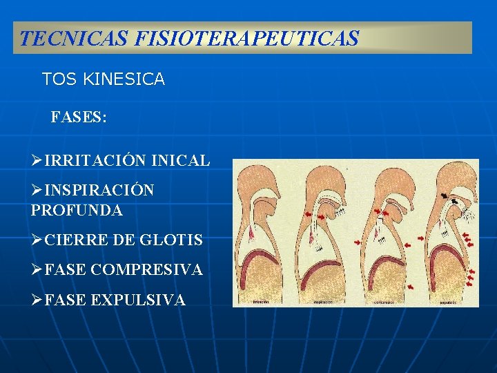 TECNICAS FISIOTERAPEUTICAS TOS KINESICA FASES: ØIRRITACIÓN INICAL ØINSPIRACIÓN PROFUNDA ØCIERRE DE GLOTIS ØFASE COMPRESIVA