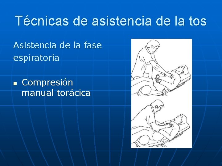 Técnicas de asistencia de la tos Asistencia de la fase espiratoria n Compresión manual