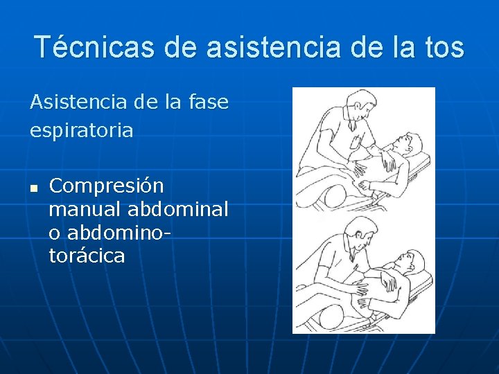 Técnicas de asistencia de la tos Asistencia de la fase espiratoria n Compresión manual