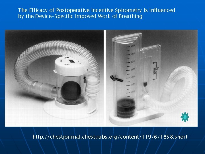 The Efficacy of Postoperative Incentive Spirometry Is Influenced by the Device-Specific Imposed Work of