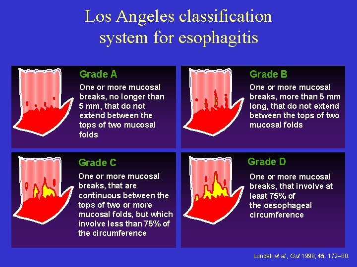 Los Angeles classification system for esophagitis Grade A Grade B One or more mucosal