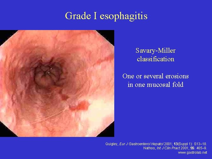 Grade I esophagitis Savary-Miller classification One or several erosions in one mucosal fold Quigley,