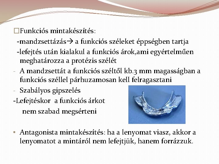 �Funkciós mintakészítés: -mandzsettázás a funkciós széleket éppségben tartja -lefejtés után kialakul a funkciós árok,