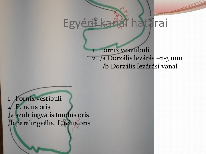 Egyéni kanál határai 1. Fornix vesztibuli 2. /a Dorzális lezárás +2 -3 mm /b