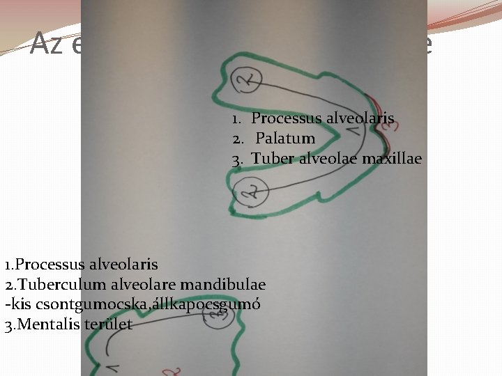 Az egyéni kanál kiterjesztése 1. Processus alveolaris 2. Palatum 3. Tuber alveolae maxillae 1. Az egyéni kanál kiterjesztése 1. Processus alveolaris 2. Palatum 3. Tuber alveolae maxillae 1.