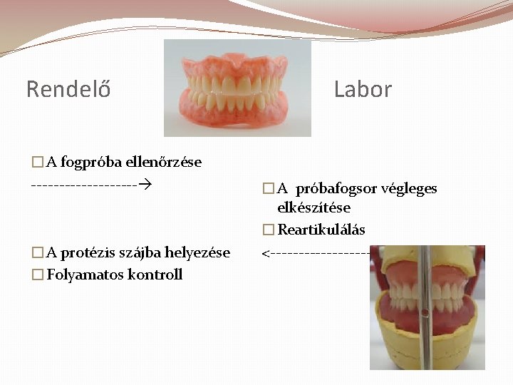 Rendelő �A fogpróba ellenőrzése ---------- �A protézis szájba helyezése �Folyamatos kontroll Labor �A próbafogsor Rendelő �A fogpróba ellenőrzése ---------- �A protézis szájba helyezése �Folyamatos kontroll Labor �A próbafogsor