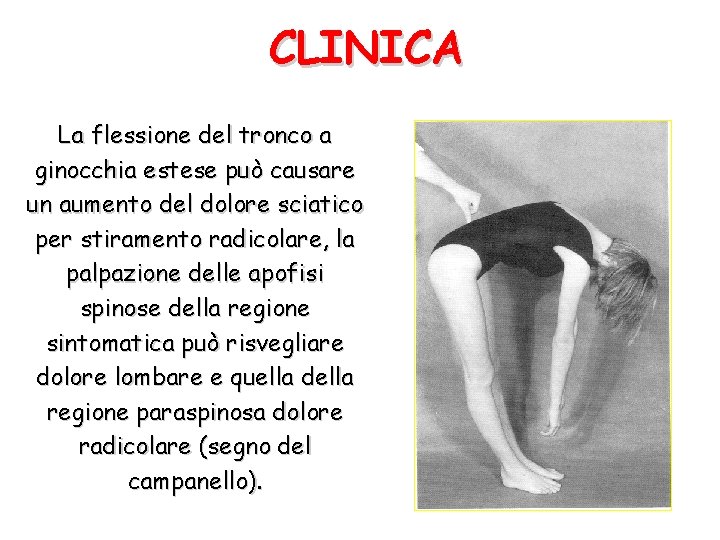CLINICA La flessione del tronco a ginocchia estese può causare un aumento del dolore