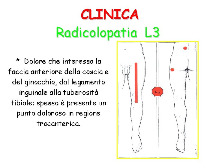 CLINICA Radicolopatia L 3 * Dolore che interessa la faccia anteriore della coscia e