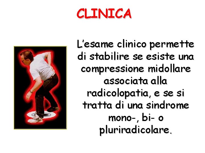 CLINICA L’esame clinico permette di stabilire se esiste una compressione midollare associata alla radicolopatia,
