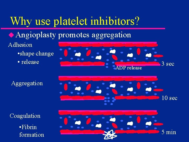 Why use platelet inhibitors? u Angioplasty Adhesion • shape change • release promotes aggregation