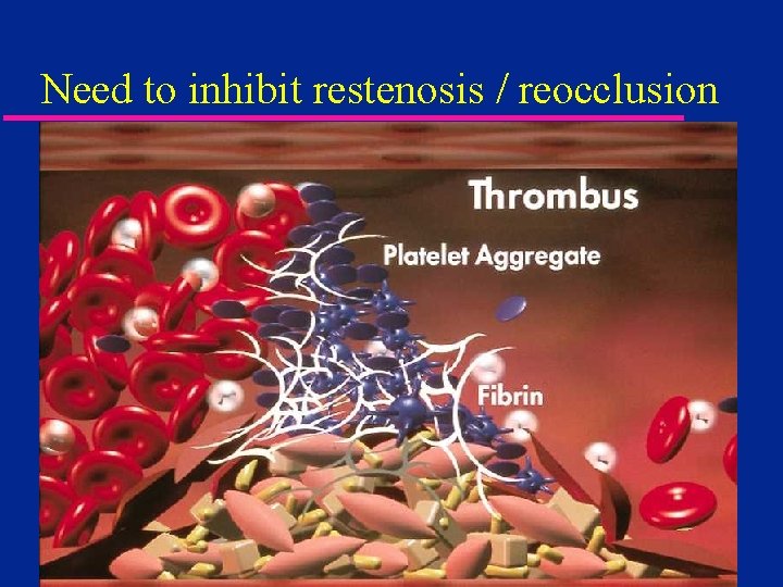 Need to inhibit restenosis / reocclusion 