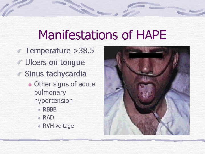 Manifestations of HAPE Temperature >38. 5 Ulcers on tongue Sinus tachycardia Other signs of