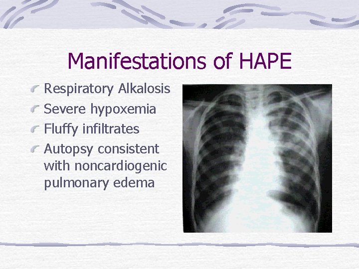 Manifestations of HAPE Respiratory Alkalosis Severe hypoxemia Fluffy infiltrates Autopsy consistent with noncardiogenic pulmonary