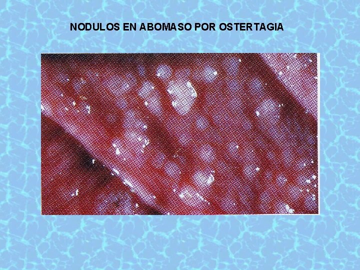 NODULOS EN ABOMASO POR OSTERTAGIA 