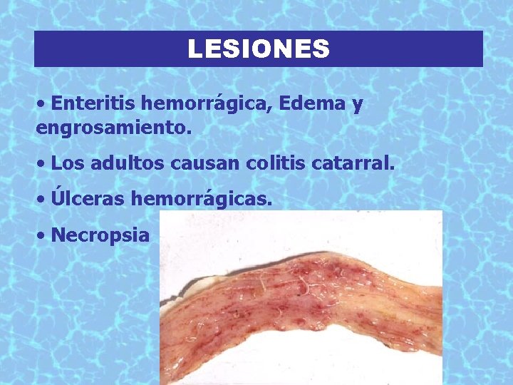 LESIONES • Enteritis hemorrágica, Edema y engrosamiento. • Los adultos causan colitis catarral. •
