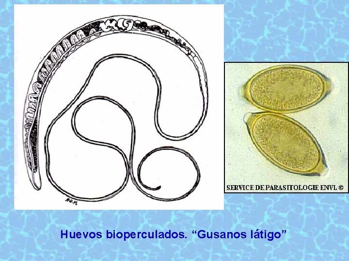 Huevos bioperculados. “Gusanos látigo” 