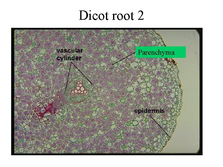 Dicot root 2 Parenchyma 