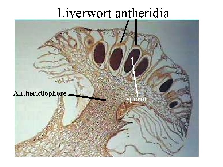 Liverwort antheridia Antheridiophore sperm 