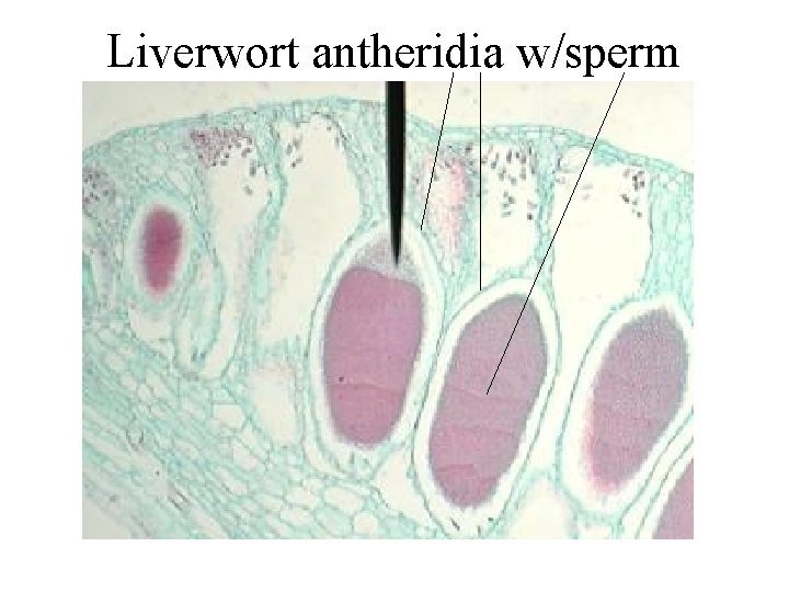 Liverwort antheridia w/sperm 