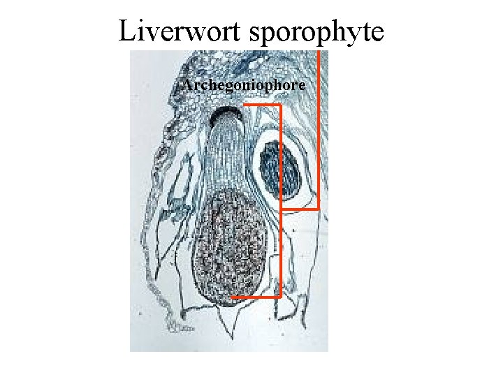 Liverwort sporophyte Archegoniophore 