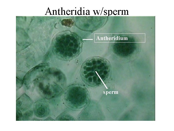 Antheridia w/sperm Antheridium sperm 