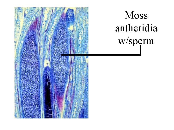 Moss antheridia w/sperm Moss antheridia w/sperm