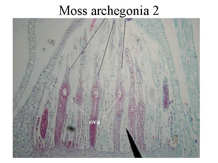 Moss archegonia 2 ova 