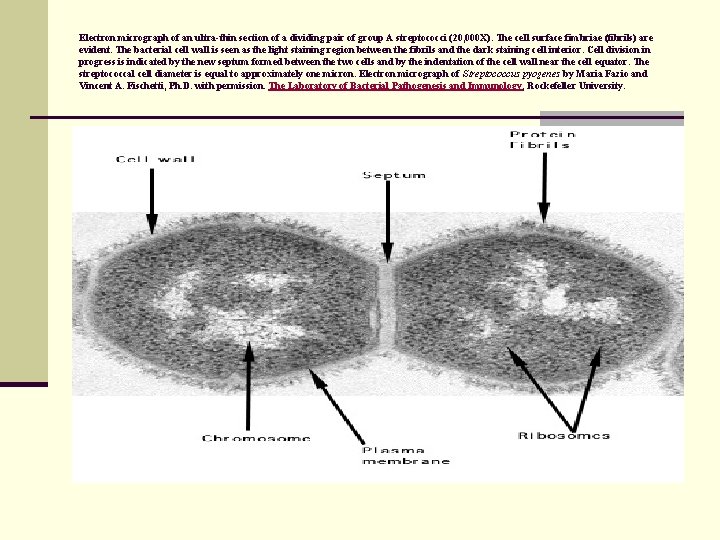 Electron micrograph of an ultra-thin section of a dividing pair of group A streptococci